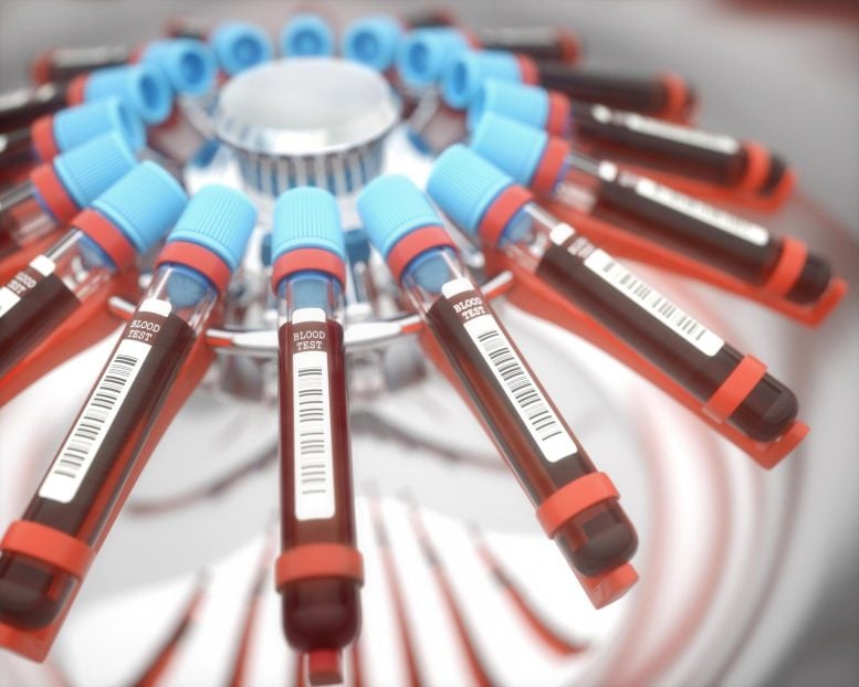 Blood Test Centrifuge