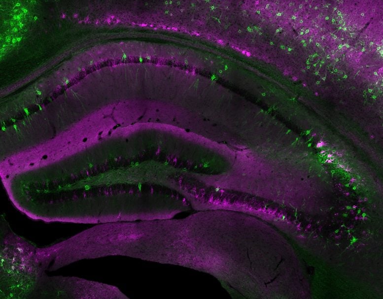 Fluorescent Microscopy Image of Mouse Hippocampus