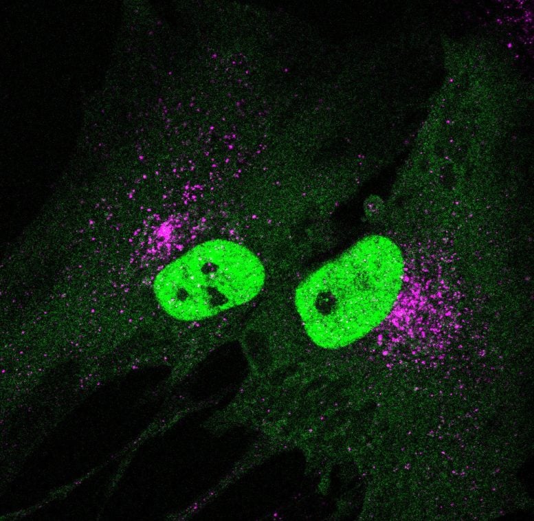 STING and TFEB Protein