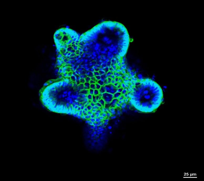 Complete Celiac Research Organoid