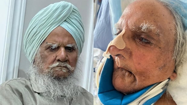 Hospital system apologizes after Brampton Sikh man’s beard shaved