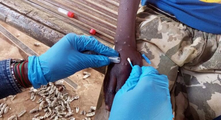 WHO approves first mpox diagnostic test for emergency use