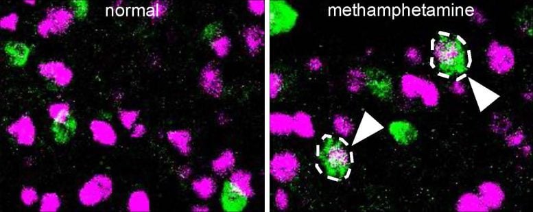 Neuron Expression of Mice on Methamphetamine