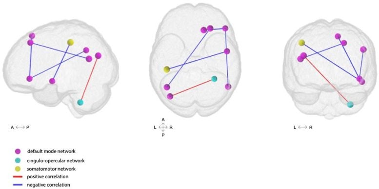 Brain Connectivity Over Time