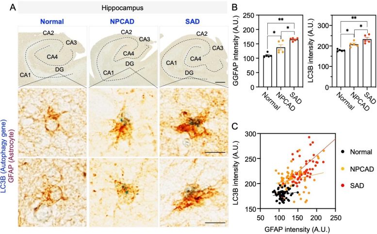 LC3B in Brain Tissue of AD Patients