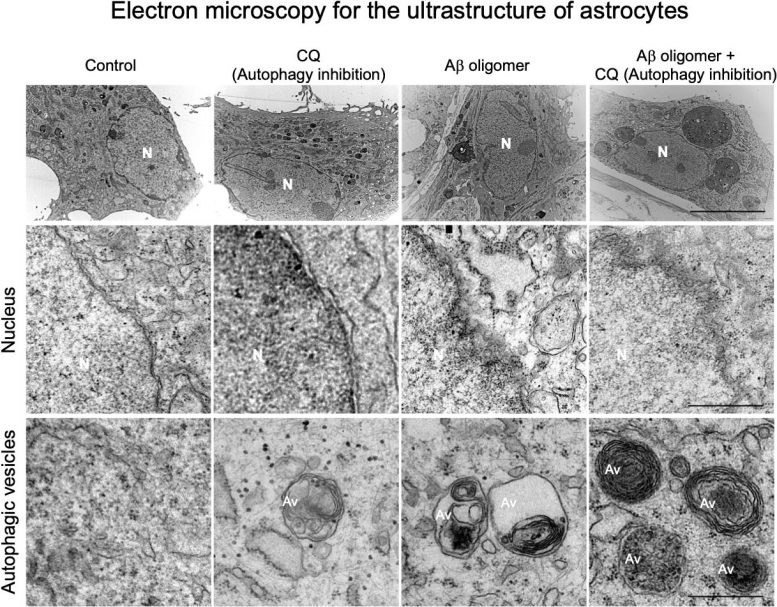 Electron Microscopy for Ultrastructure of Astrocytes