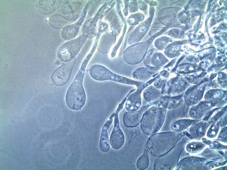 Magnified Image of Nutritive Vesicles Produced by Ant-Cultivated Fungus