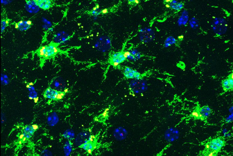 Inflammatory Microglia From a Female Brain in a Mouse Model of Alzheimer’s Disease