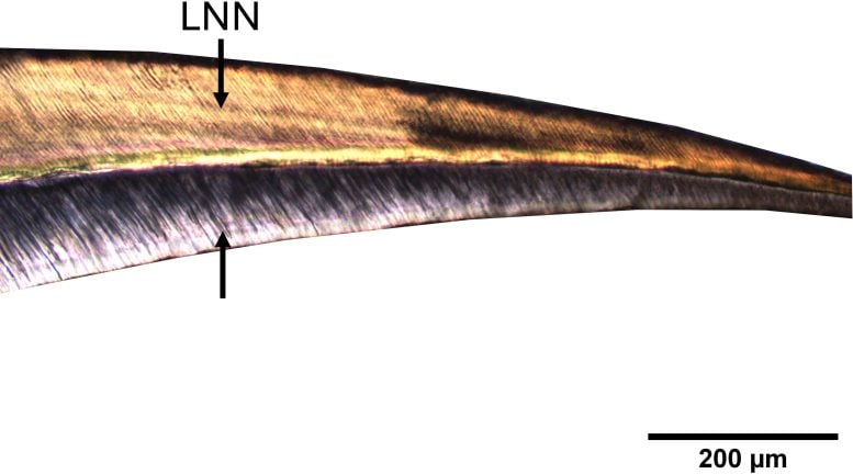 Neonatal Line of a Baby’s Central Incisor From the Olèrdola Site