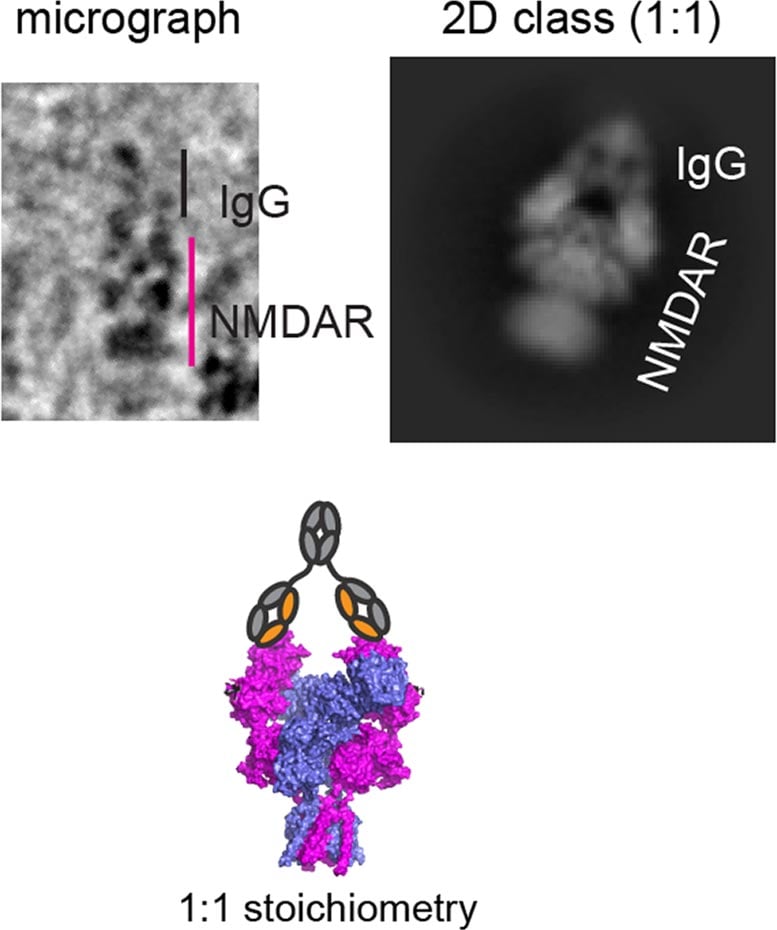 Antibody and NMDAR Pattern