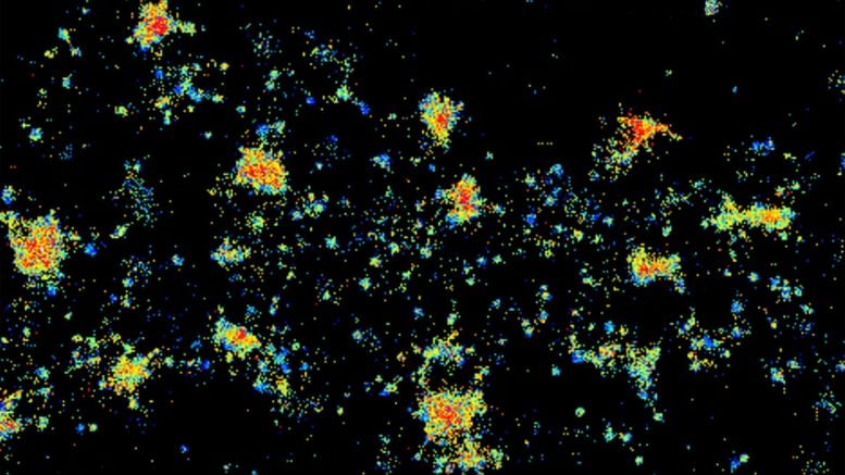 Antibodies Binding to NMDARs