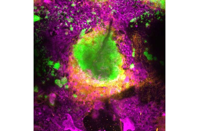 A lung pathogen's dilemma: infect or resist antibiotics?