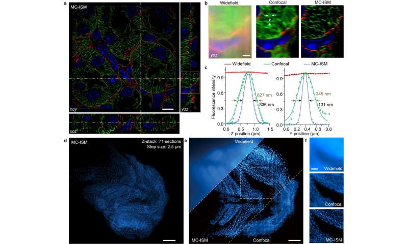 Super-resolution imaging of living tissues achieved by multi-confocal image scanning microscopy