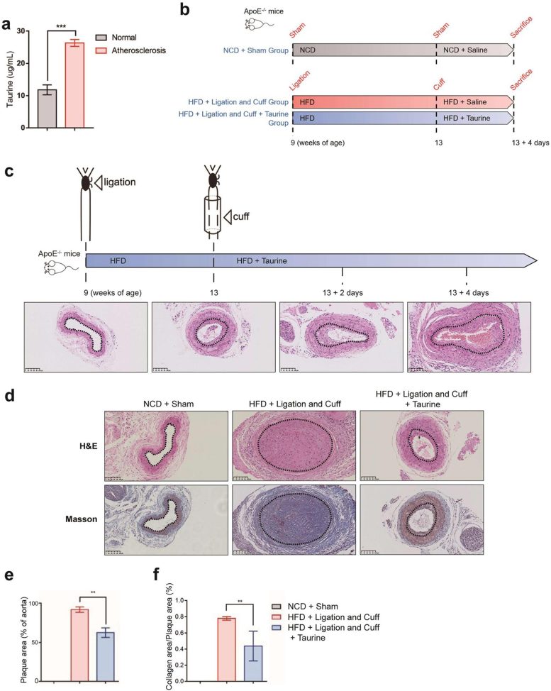 Taurine Atherosclerotic Plaque Formation