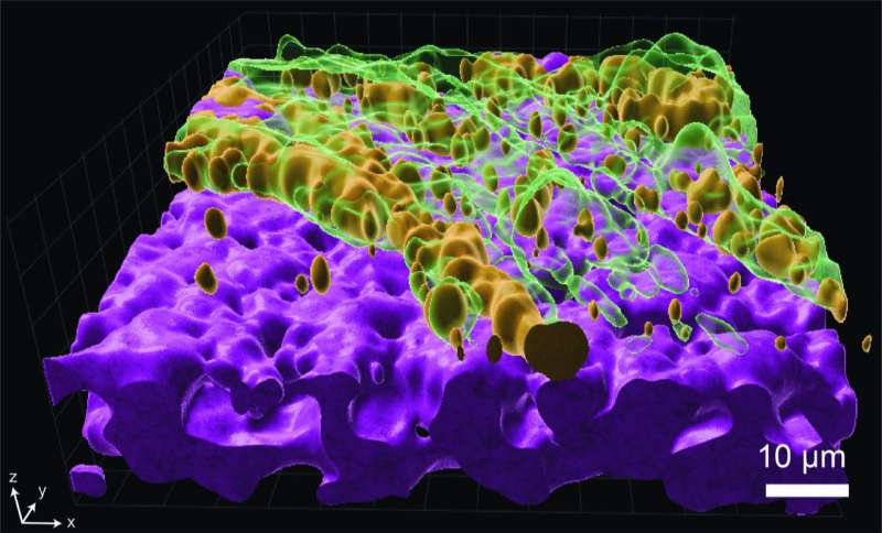 A lung pathogen's dilemma: infect or resist antibiotics?