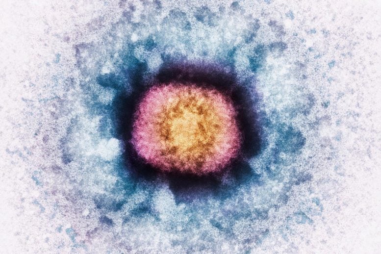 Vaccinia Virus Particle