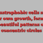 Claustrophobic cells slow their own growth, forming beautiful patterns of concentric circles