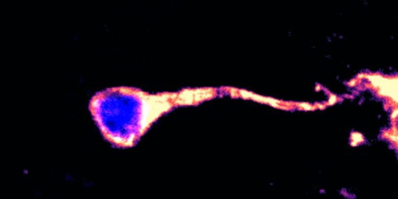 Single Quiescent Neural Stem Cell