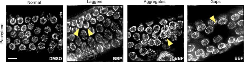 Plastic Chemical Causes Causes DNA Breakage and Chromosome Defects in Sex Cells