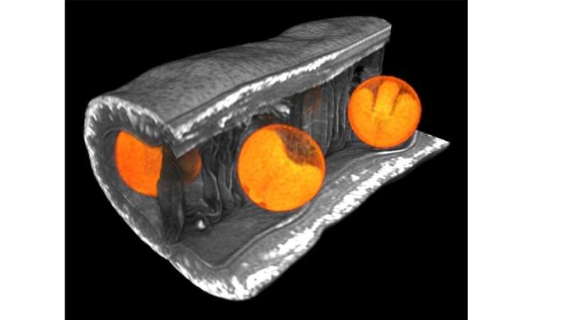 When things get tight: How does the embryo in the rapeseed react to mechanical constraints?