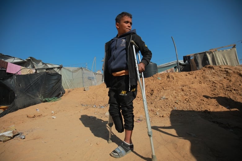 A 12 year old boy is holding crutches. He's looking off to the side with a blank look on his face. He's standing in front of a shanty town of homes made of plastic bags and blankets in the Gaza strip. His right leg is amputated below the knee. He's wearing black sweatpants, a blue hoodie and a black jacket. 