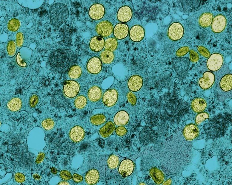 Colorized Transmission Electron Micrograph of Mpox Virus Particles Found Within VERO E6 Cells