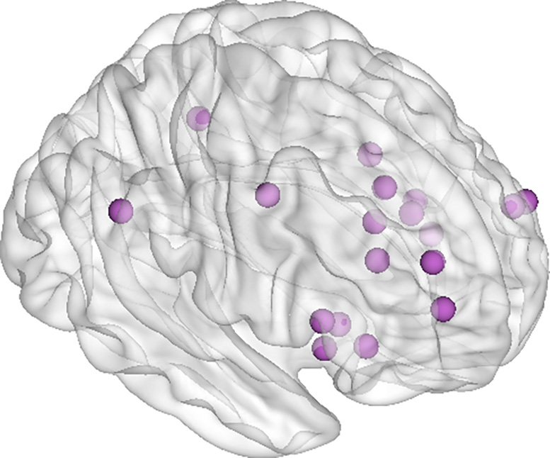 Salience Network Locations Related to Dementia’s Behavioral Impacts