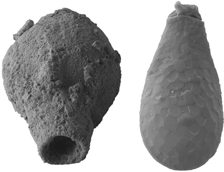 Fossilized Thecamoebian and Amoebozoan Testate Amoebae Specimen