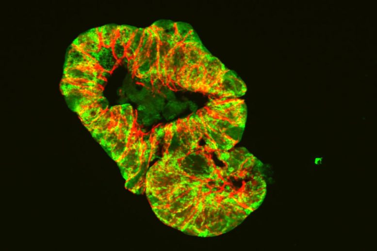 Microscopic Image of Intestinal Organoid