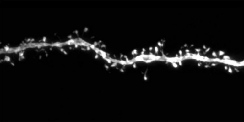 Dendrite From a 12 Month Old Human Cerebral Cortex Neuron