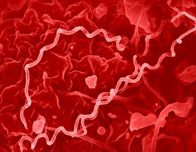 Colorized electron micrograph of Treponema pallidum, the spiral-shaped bacteria that cause syphilis. 