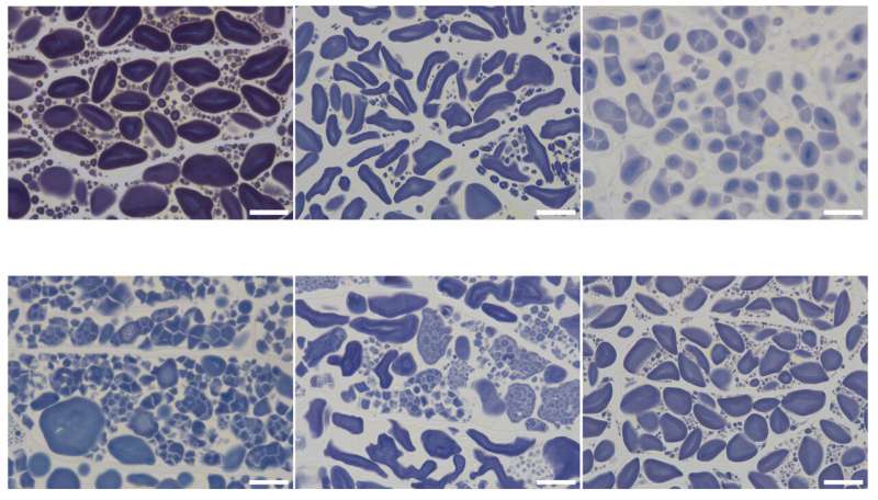 Understanding the influence of specific gene mutations on starch properties in barley