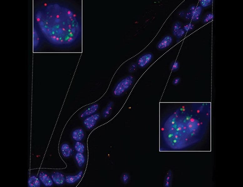 DNA Damage Within Telomeres