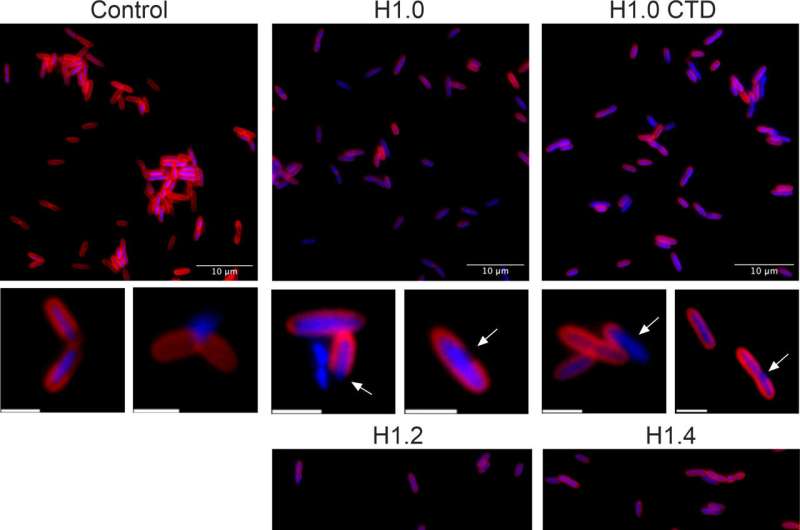 Histones against bacterial infections