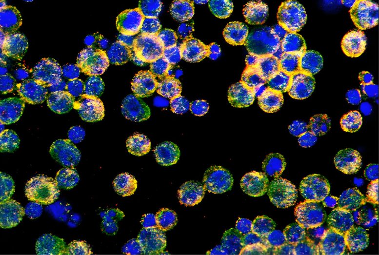 TAGLN2 and FABP5 Proteins