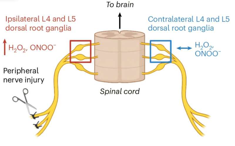 Researchers discover localized pain relief using known chemical reaction