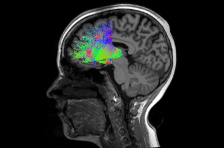 Mediodorsal Thalamus and Prefrontal Cortex