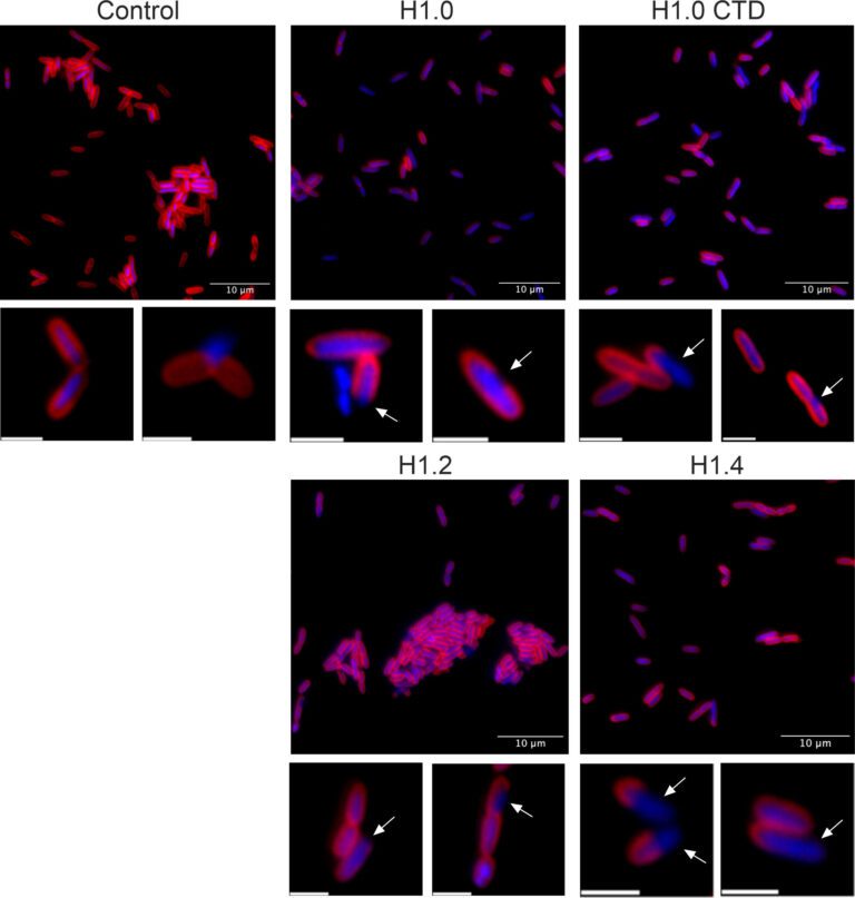 Human histones show promise in fighting bacterial infections